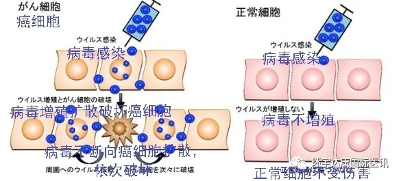 溶瘤病毒疗法