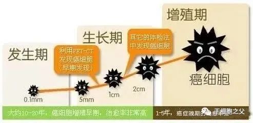 肿瘤绿色治疗-NK细胞治疗