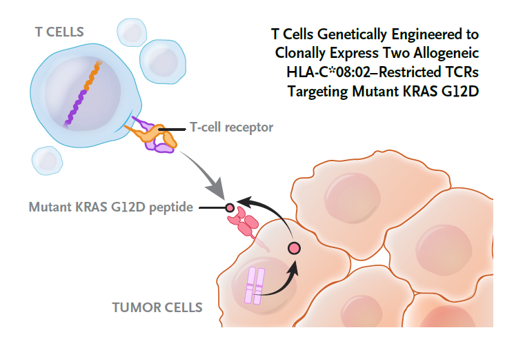 靶向KRAS G12D多肽的TCR细胞疗法