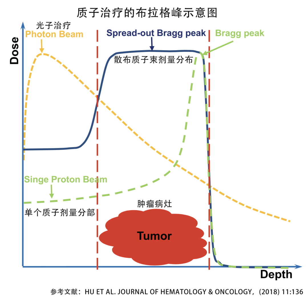 质子治疗的布拉格峰示意图