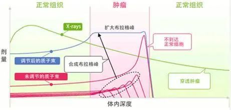 质子治疗肿瘤