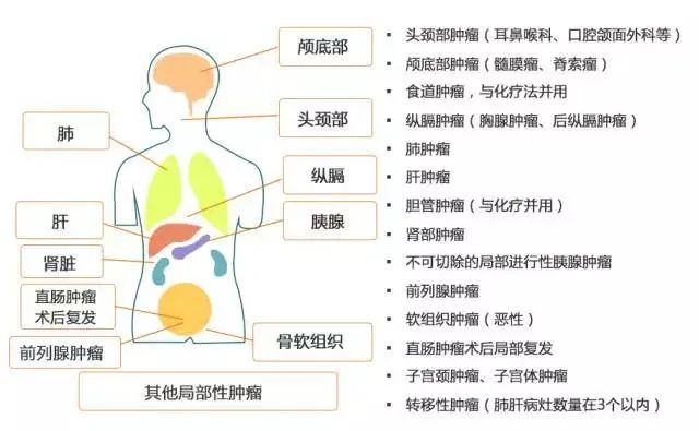 质子治疗适应症