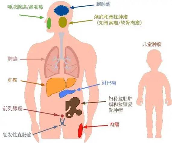 质子重离子适应症