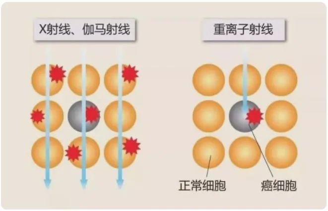 不同放射线对癌细胞的杀伤对比