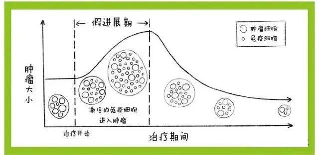 免疫治疗的真假进展期