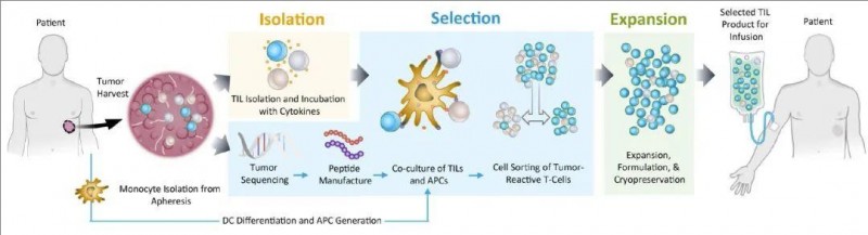 新型TIL疗法——TIDAL-01