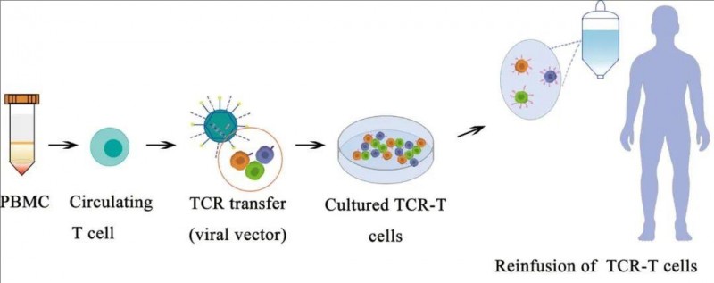 TCR-T细胞疗法治疗流程