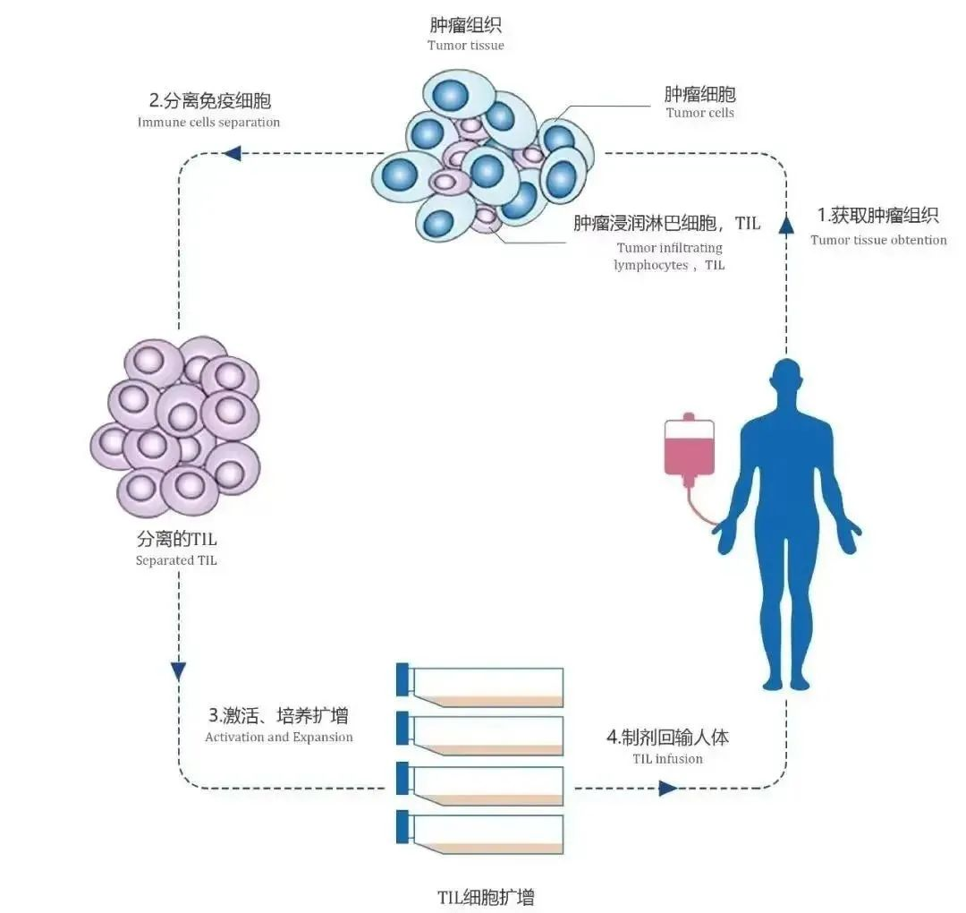 TIL细胞疗法的治疗流程