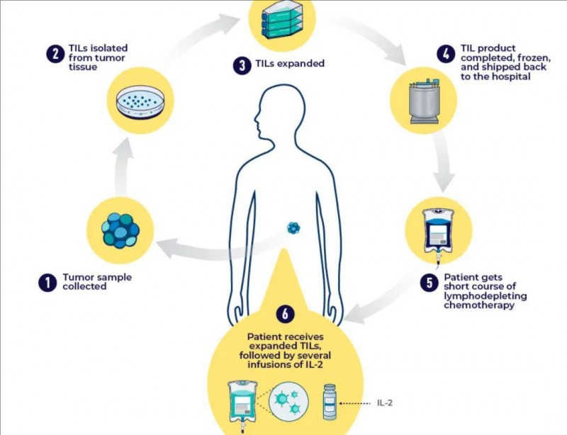 TIL细胞疗法治疗流程