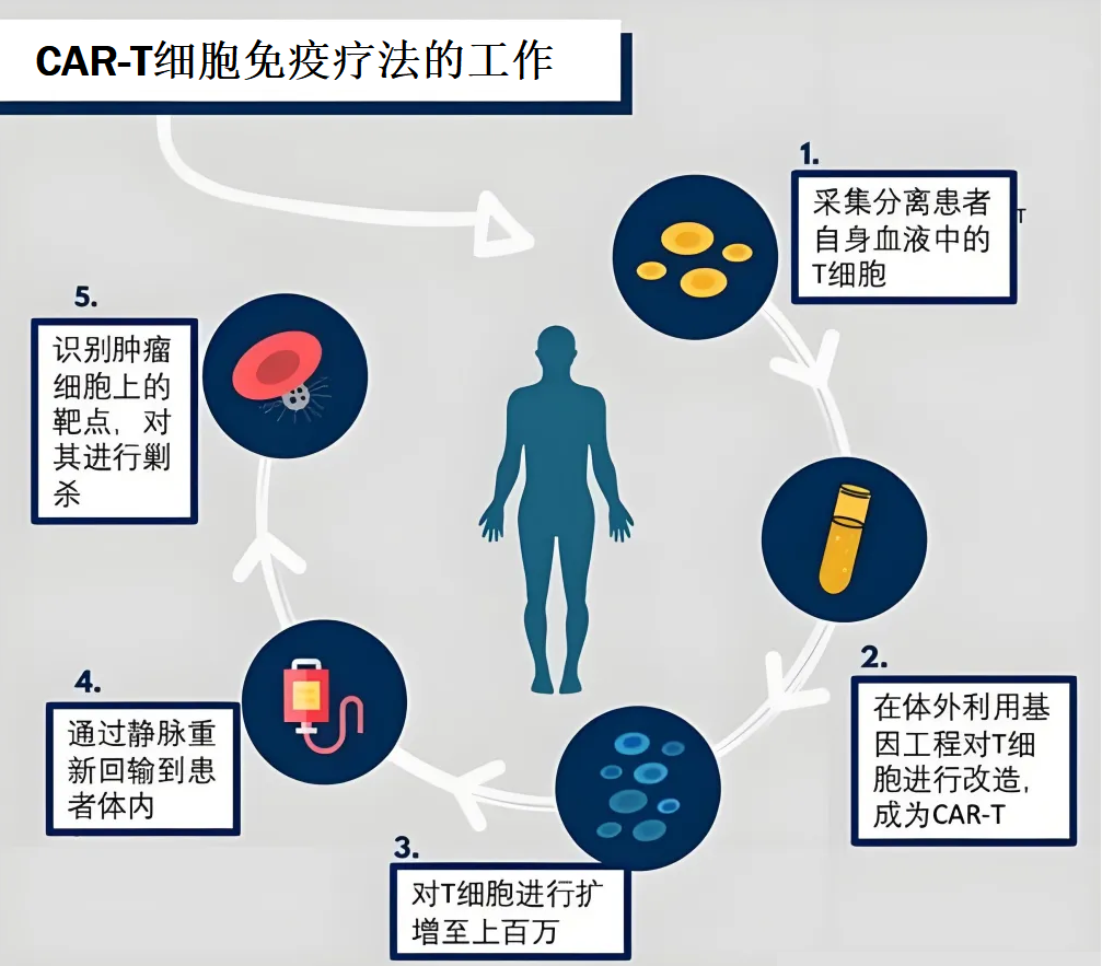 美国斯坦福大学关于CAR-T细胞免疫疗法研究的突破性进展