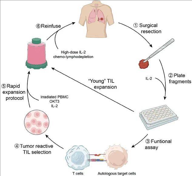 TIL细胞的生产与治疗过程