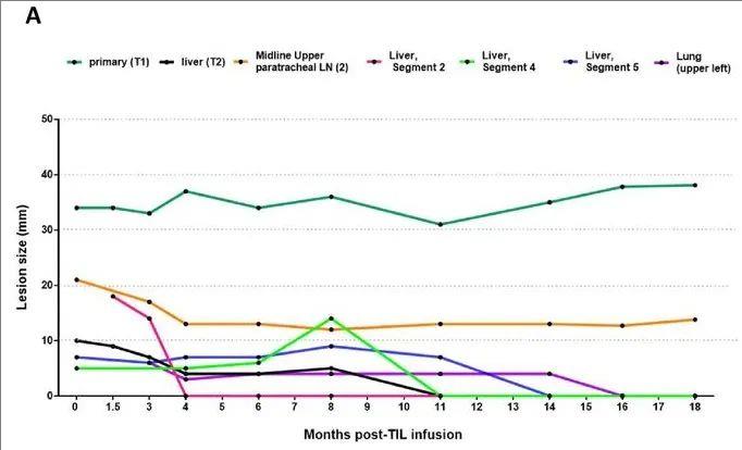 TIL疗法治疗胰腺癌的数据