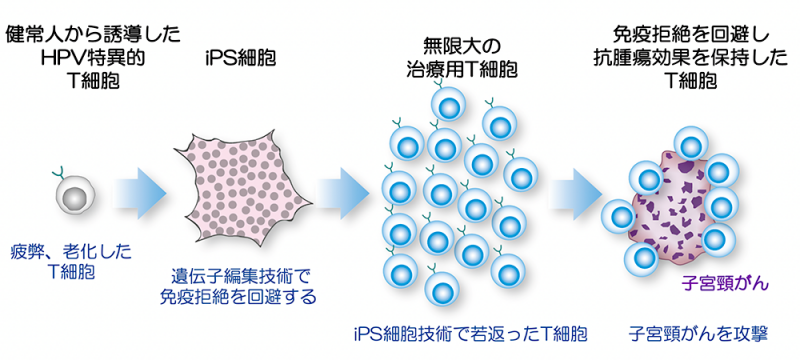 顺天堂大学探索CTL细胞疗法,为宫颈癌患者带来新的希望