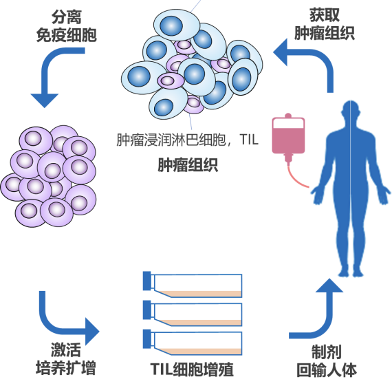 肿瘤浸润淋巴细胞(TIL)疗法全面解析