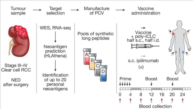个性化癌症疫苗治疗肾癌的过程