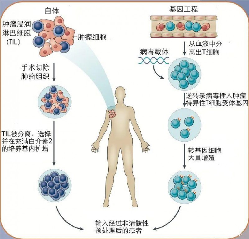 TIL细胞疗法治疗过程