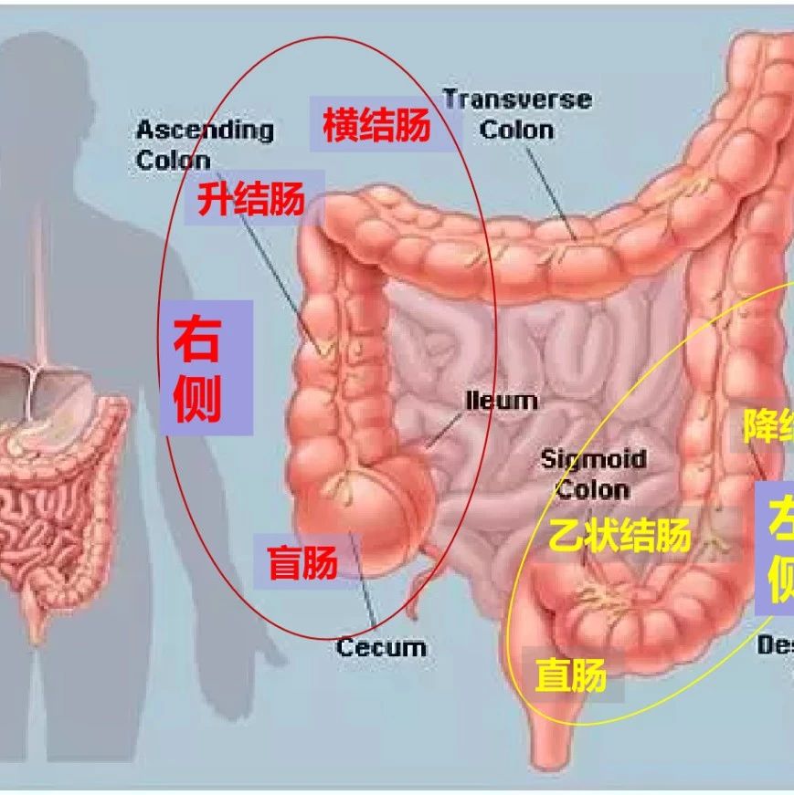 结直肠癌靶向药物,结直肠癌治疗方案,结直肠癌靶向治疗方案,结直肠癌免疫治疗方案