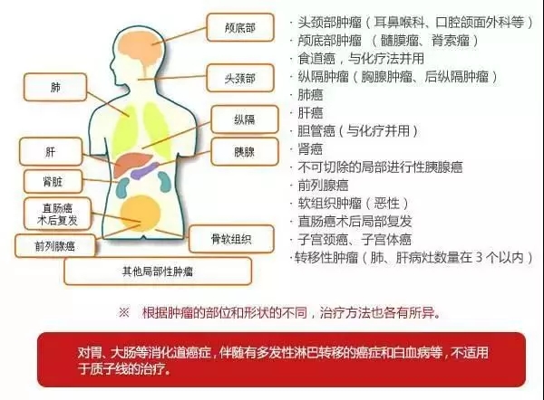 质子治疗适应症