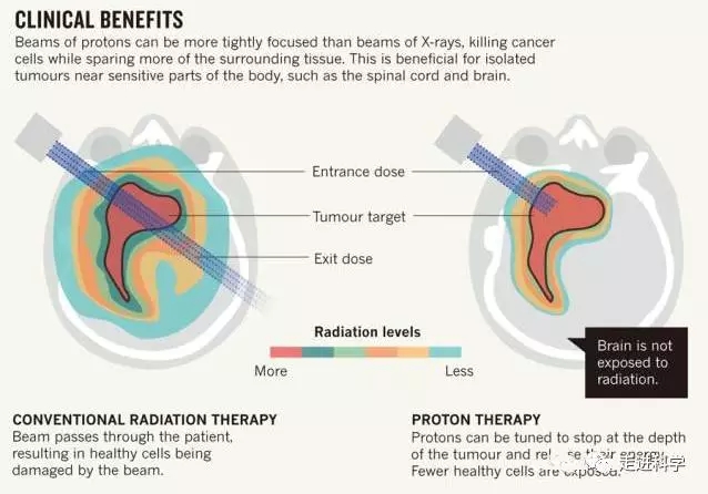 质子治疗的优势