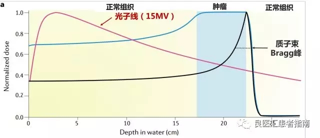 湖南省肿瘤医院放射治疗科刘怀医生:探秘肿瘤质子治疗