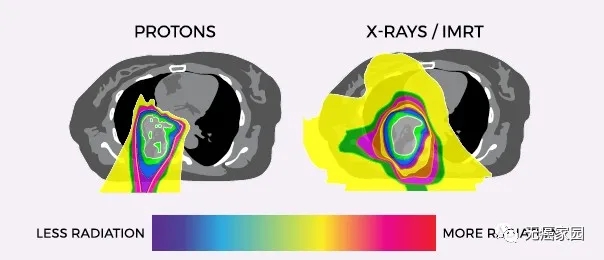 肺癌质子治疗和传统放疗对比