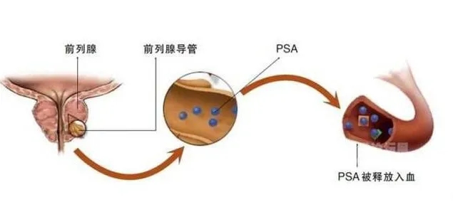 疟原虫治疗肿瘤