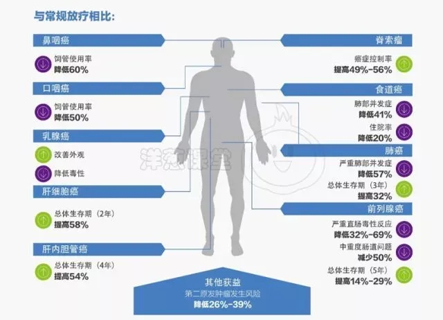 质子治疗各癌种的治愈率