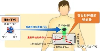 重离子线放射能量