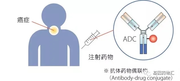 注射抗体偶联药物