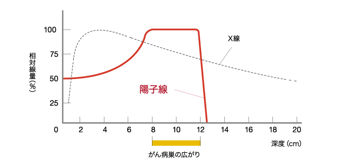 质子重离子治疗是什么意思