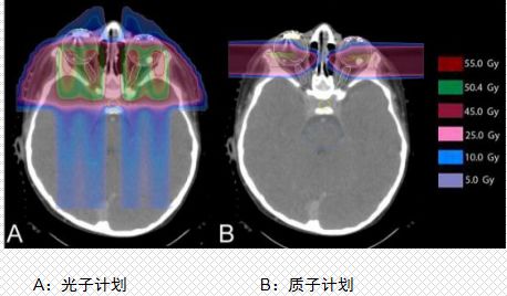 质子治疗和光子治疗对比