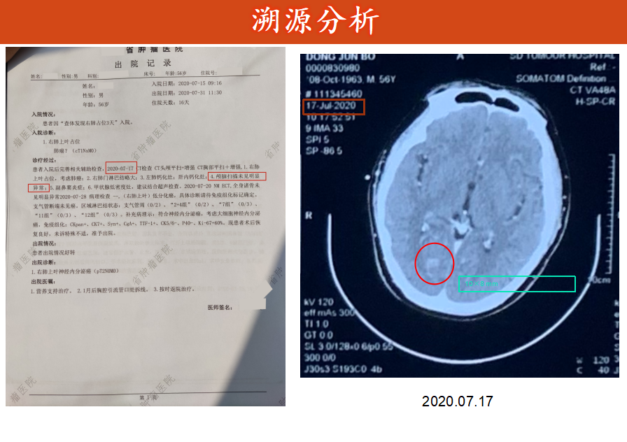 肺癌检查报告