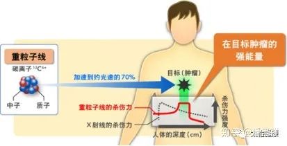 重离子治疗原理