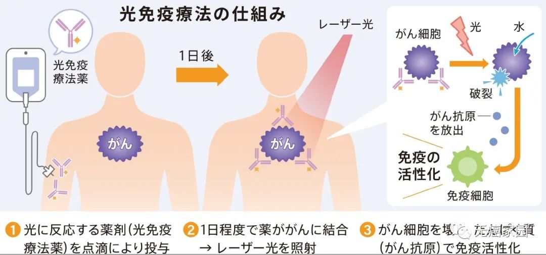 狙击癌细胞,不损伤正常细胞!号称"第五种癌症疗法"的光免疫疗