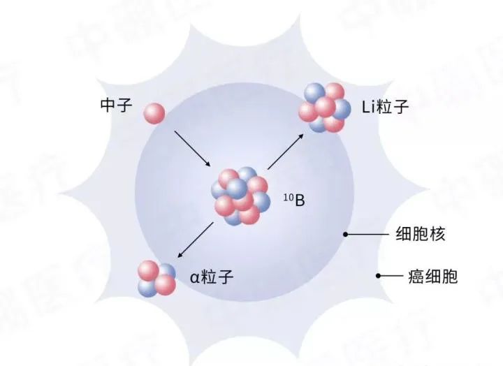 什么是硼中子俘获治疗(bnct)