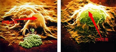 同样是免疫细胞,CIK细胞和NK细胞有什么区别?