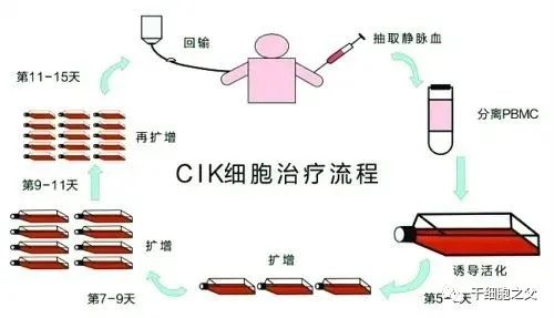 CIK细胞治疗流程