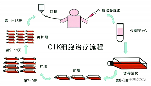 CIK细胞免疫疗法治疗流程