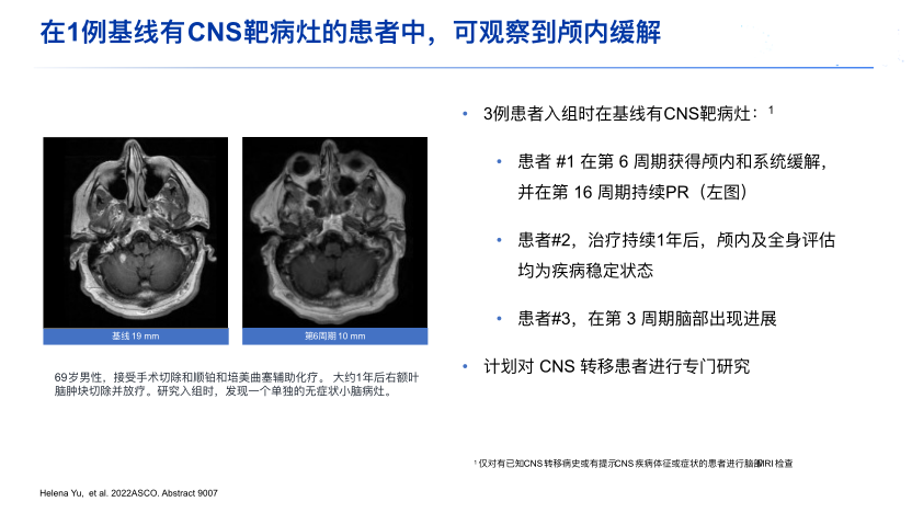 非小细胞肺癌罕见的"EGFR第三大突变"终被攻克!多款国内外