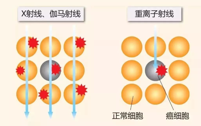 不同射线对比