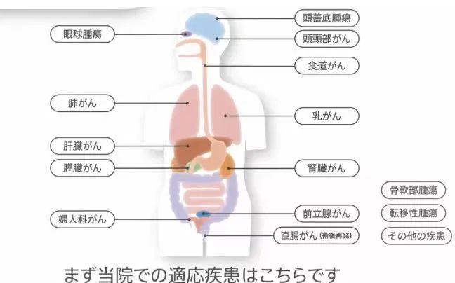 质子重离子可以治疗哪些肿瘤