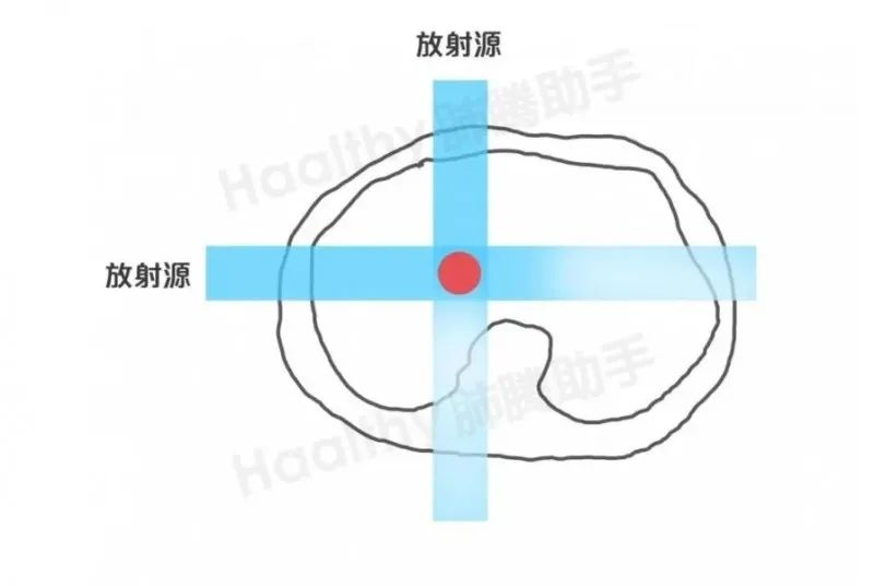 质子重离子技术