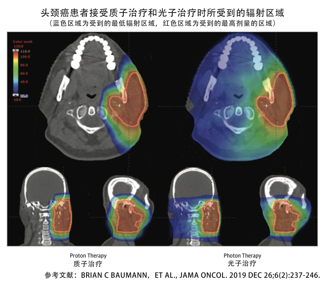 质子治疗适用哪些肿瘤