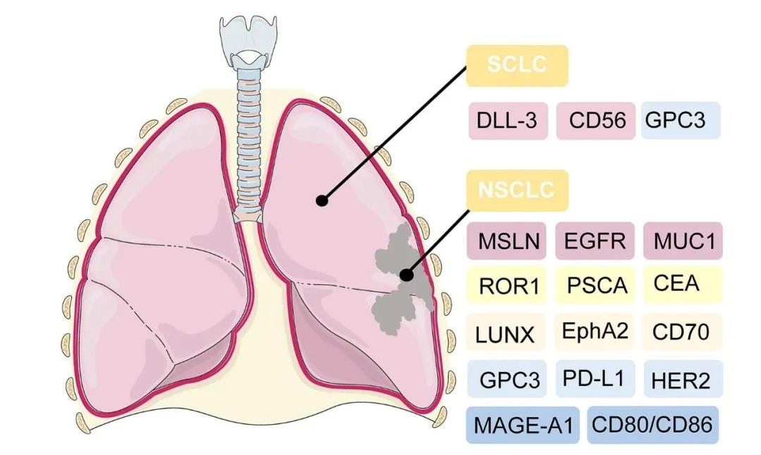 CAR-T治疗肺癌的潜在靶向抗原