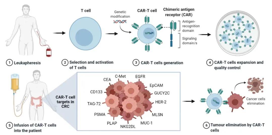 CAR-T疗法治疗流程