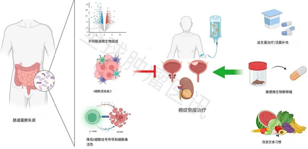 肠道微生物组与癌症免疫治疗的潜在机制与结果