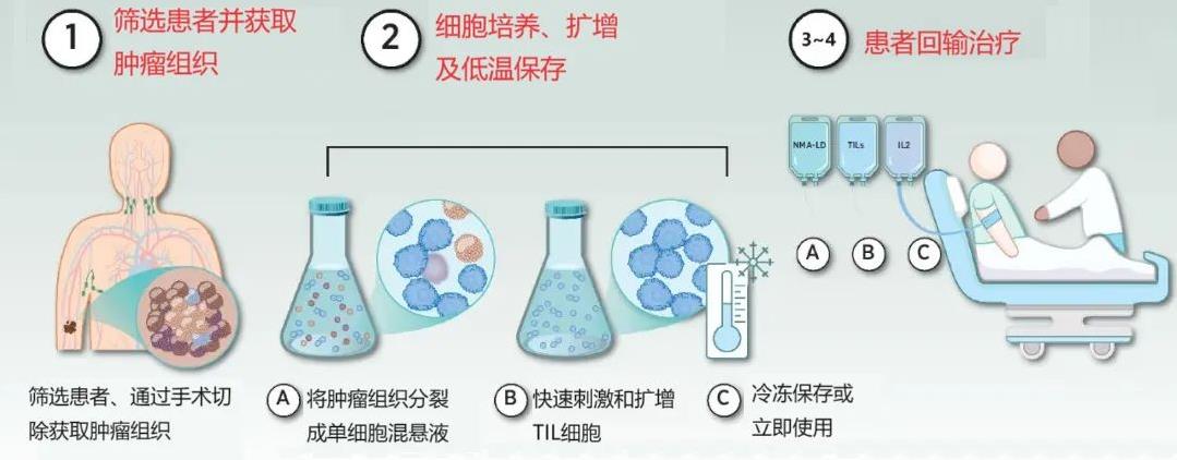 TIL疗法的主要治疗过程示例图