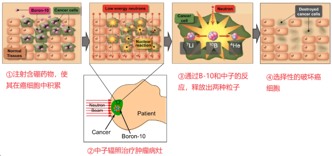 30分钟击破肿瘤?抗癌新星-硼中子疗法深入细胞内部精准绝杀,让癌细胞无处遁形