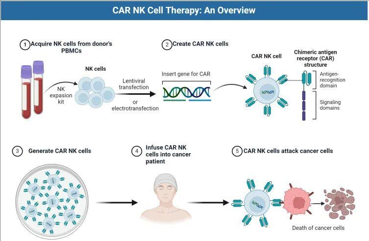 CAR-NK治疗流程