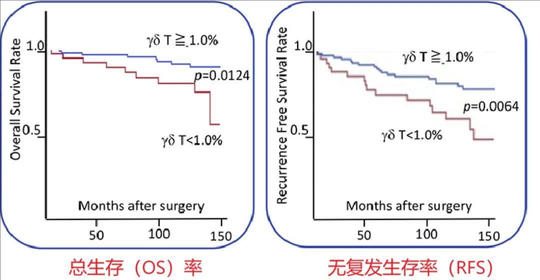 γδT细胞治疗肾癌的效果